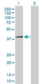 HSD3B2 Antibody in Western Blot (WB)