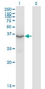 HSD3B2 Antibody in Western Blot (WB)