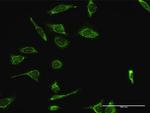 HSPA9 Antibody in Immunocytochemistry (ICC/IF)