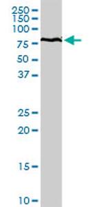 HSPA9 Antibody in Western Blot (WB)