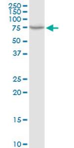 HSPA9 Antibody in Western Blot (WB)