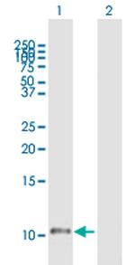 HTN1 Antibody in Western Blot (WB)