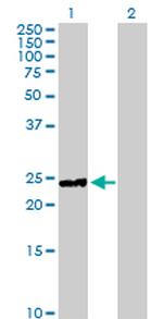 HYAL1 Antibody in Western Blot (WB)