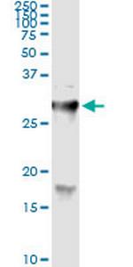 HYAL1 Antibody in Immunoprecipitation (IP)