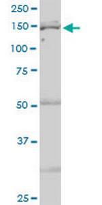 IARS Antibody in Western Blot (WB)