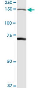 IARS Antibody in Western Blot (WB)