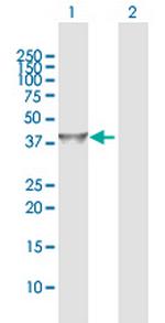 IDH3G Antibody in Western Blot (WB)