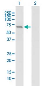 IFIT1 Antibody in Western Blot (WB)