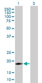 IFNA16 Antibody in Western Blot (WB)