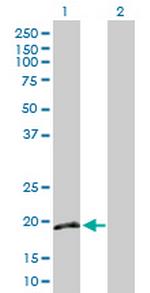 IFNA16 Antibody in Western Blot (WB)