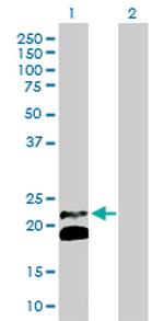 IFNB1 Antibody in Western Blot (WB)