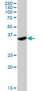 IFNGR2 Antibody in Western Blot (WB)