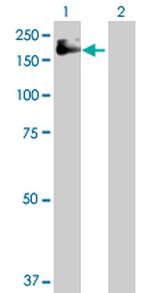 IGF1R Antibody in Western Blot (WB)