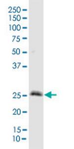 IGFBP3 Antibody in Western Blot (WB)