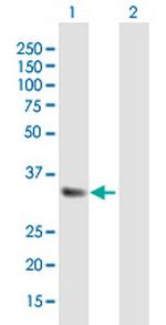 IGFBP5 Antibody in Western Blot (WB)