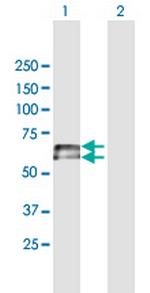 IGHD Antibody in Western Blot (WB)