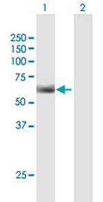 IGHG3 Antibody in Western Blot (WB)