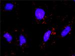 IKBKB Antibody in Proximity Ligation Assay (PLA) (PLA)