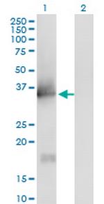 IL1A Antibody in Western Blot (WB)