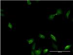 IL1A Antibody in Immunocytochemistry (ICC/IF)