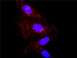 IL1B Antibody in Proximity Ligation Assay (PLA) (PLA)