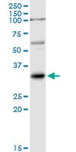 IL1B Antibody in Western Blot (WB)