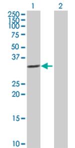 IL1B Antibody in Western Blot (WB)