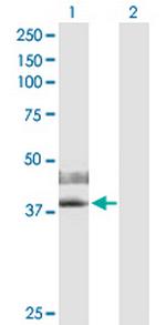 IL2RG Antibody in Western Blot (WB)