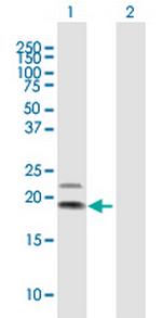 IL4 Antibody in Western Blot (WB)