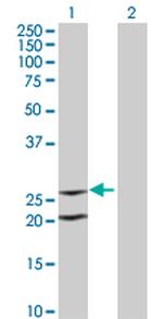 IL6 Antibody in Western Blot (WB)