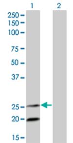 IL6 Antibody in Western Blot (WB)