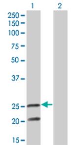 IL6 Antibody in Western Blot (WB)