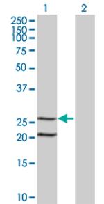 IL6 Antibody in Western Blot (WB)