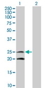 IL6 Antibody in Western Blot (WB)