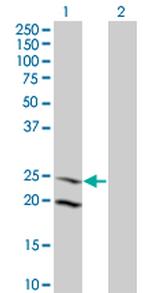 IL6 Antibody in Western Blot (WB)