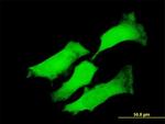 IL6 Antibody in Immunocytochemistry (ICC/IF)