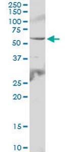 IL6R Antibody in Western Blot (WB)