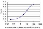 IL6R Antibody in ELISA (ELISA)