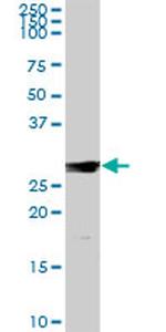 IL7 Antibody in Western Blot (WB)