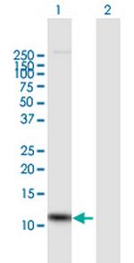 IL8 Antibody in Western Blot (WB)