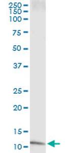 IL8 Antibody in Immunoprecipitation (IP)