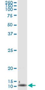 IL8 Antibody in Immunoprecipitation (IP)