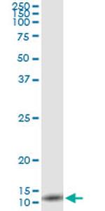 IL8 Antibody in Immunoprecipitation (IP)