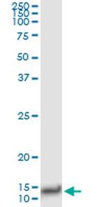 IL8 Antibody in Immunoprecipitation (IP)