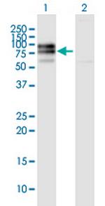 IL10RA Antibody in Western Blot (WB)