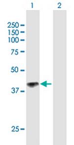 IL12RB1 Antibody in Western Blot (WB)