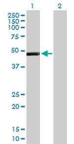 IL13RA2 Antibody in Western Blot (WB)