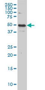 IL13RA2 Antibody in Western Blot (WB)