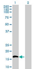 IL15 Antibody in Western Blot (WB)