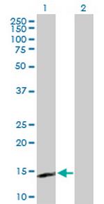 IL15 Antibody in Western Blot (WB)